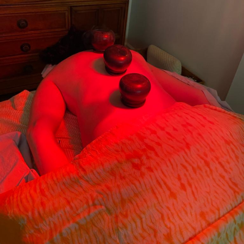 Cupping therapy nyc