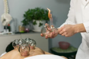 chinese fire cupping