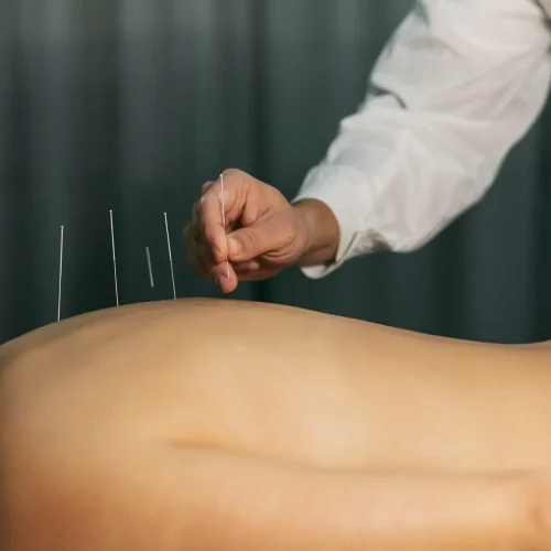 acupuncture for fertility near me