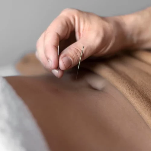 acupuncture for weight loss ny